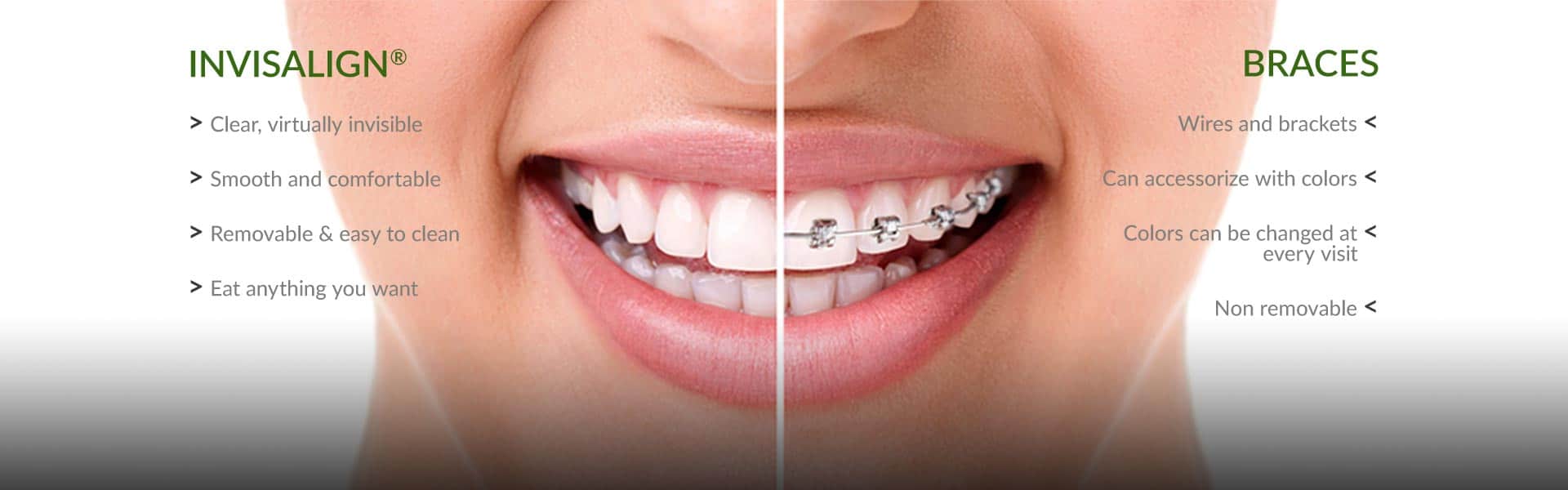 Orthodontist Dr. Robert Kazmierski Moorestown, NJ Moorestown Orthodontics